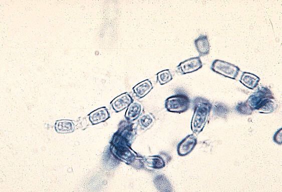 Paracoccidia הם סוכני סיבתיות של paracoccidioidosis